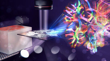 Mijlpaal hersenonderzoek: het doolhof van zenuwvezels in kaart brengen